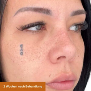Freckles 2 Wochen